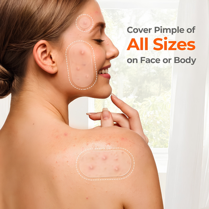 Amure™ 609 Count Hydrocolloid Pimple Patches for All Skin Types
