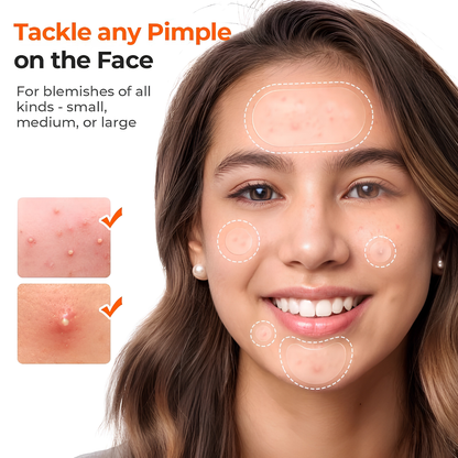 Amure™ 609 Count Hydrocolloid Pimple Patches for All Skin Types
